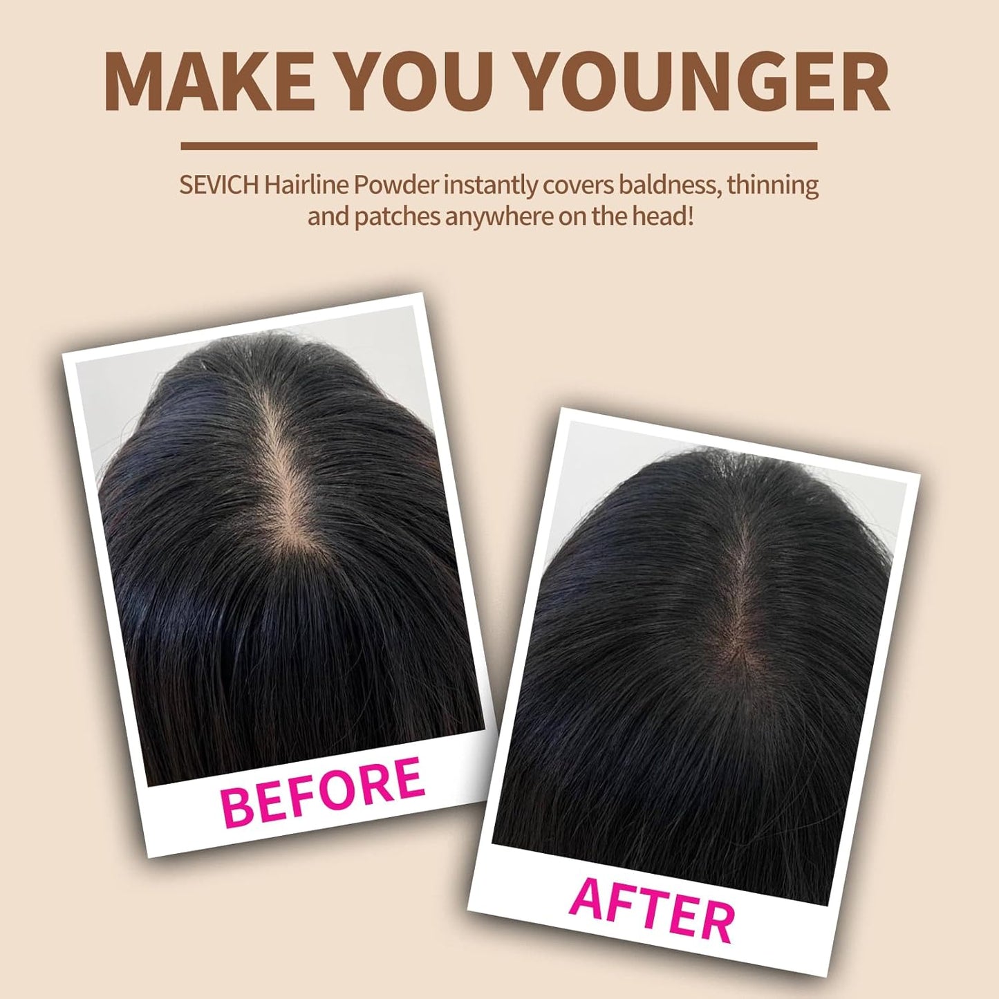 SEVICH Hairline Shadow Powder - Quick Cover for Grey Roots, Eyebrows & Beards, Touch Up Thinning Hair, Windproof & Sweatproof, Light Coffee