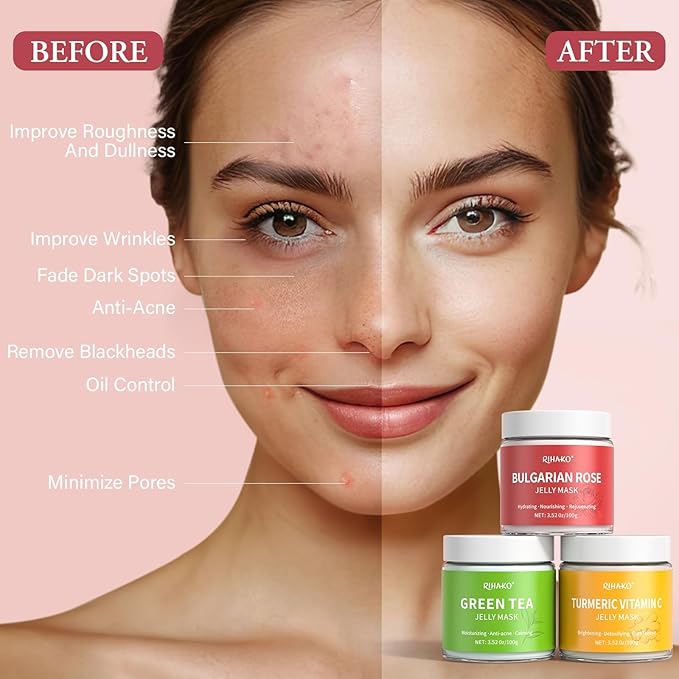 Jelly Mask For Facial Skincare Gift Kits, Peel-Off Hydrating Icy Jelly Mask, Hydrogel Jelly Face Mask Set,Turmeric Vitamin C, Rose & Green Tea,Diy Home Spa Kit - Gift for Him & Her